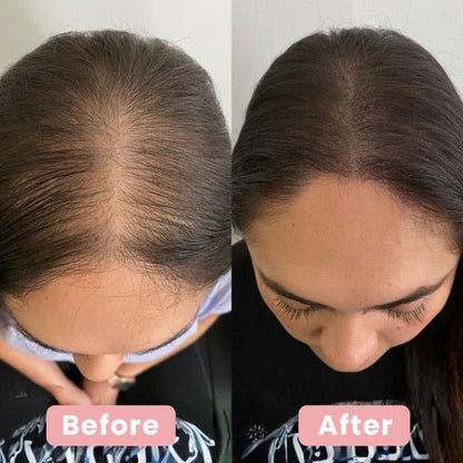 4 in 1 Hair Renewal Brush